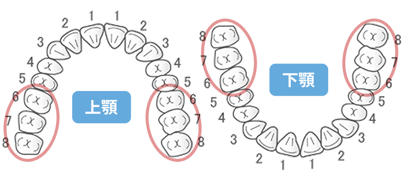 CAD/CAMの保険適用範囲